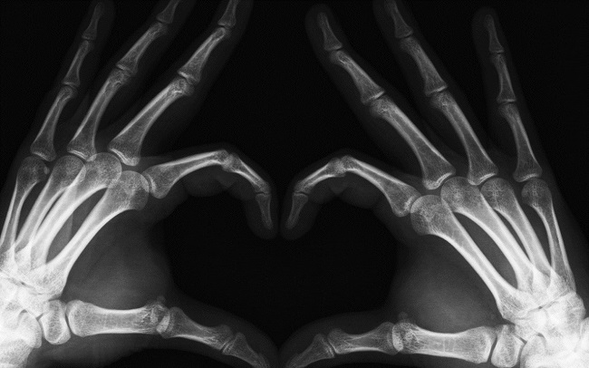 Рентген пальцев ноги или руки