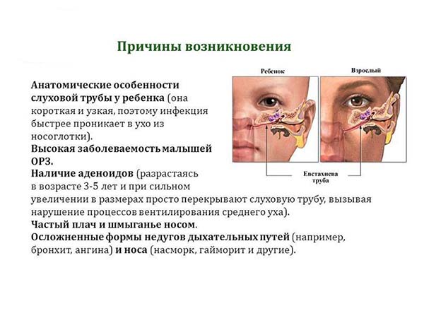 Тубоотит – симптомы, признаки, причины и лечение евстахиита у взрослых в «СМ-Клиника»