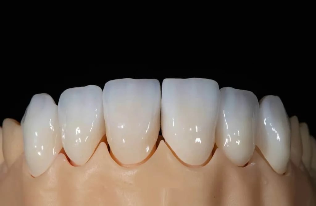 Коронки на зубы из диоксида циркония